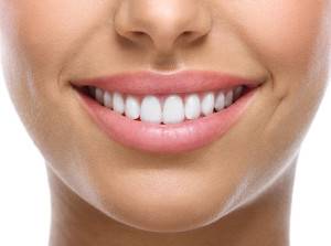 DIY Teeth Whitening: Smile Brilliant Review [Updated 2024] 21